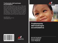 Buchcover von Trattamento dell'esotropia accomodativa