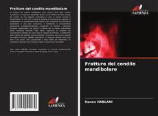 Borítókép a  Fratture del condilo mandibolare - hoz