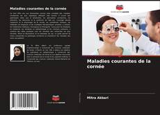 Bookcover of Maladies courantes de la cornée