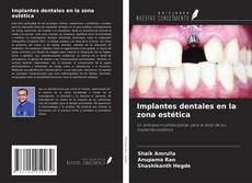 Implantes dentales en la zona estética的封面