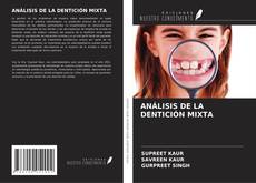 Capa do livro de ANÁLISIS DE LA DENTICIÓN MIXTA 