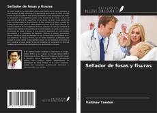 Bookcover of Sellador de fosas y fisuras