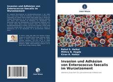 Bookcover of Invasion und Adhäsion von Enterococcus faecalis im Wurzelzement