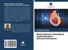 Buchcover von Betavoltaisch betriebene implantierbare Herzschrittmacher