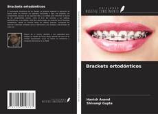 Couverture de Brackets ortodónticos
