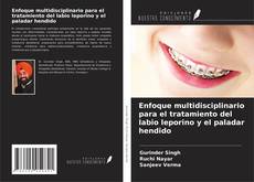 Couverture de Enfoque multidisciplinario para el tratamiento del labio leporino y el paladar hendido