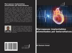 Borítókép a  Marcapasos implantables alimentados por betavoltaicos - hoz