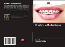 Brackets orthodontiques的封面