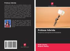 Prótese híbrida的封面