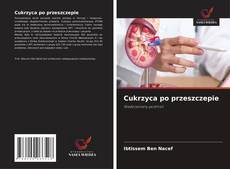 Обложка Cukrzyca po przeszczepie