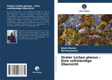 Buchcover von Oraler Lichen planus – Eine vollständige Übersicht