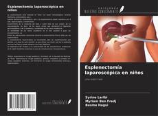Couverture de Esplenectomía laparoscópica en niños