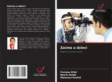 Bookcover of Zaćma u dzieci