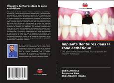 Implants dentaires dans la zone esthétique的封面