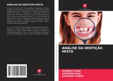 Capa do livro de ANÁLISE DA DENTIÇÃO MISTA 