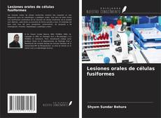 Couverture de Lesiones orales de células fusiformes