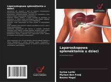 Laparoskopowa splenektomia u dzieci kitap kapağı
