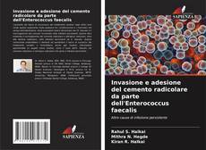 Buchcover von Invasione e adesione del cemento radicolare da parte dell'Enterococcus faecalis