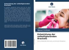 Buchcover von Entwicklung der selbstligierenden Brackets