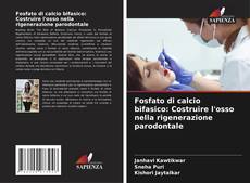 Buchcover von Fosfato di calcio bifasico: Costruire l'osso nella rigenerazione parodontale