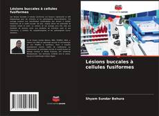 Bookcover of Lésions buccales à cellules fusiformes