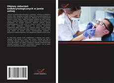 Capa do livro de Objawy zaburzeń endokrynologicznych w jamie ustnej 