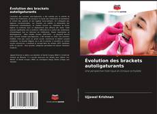 Capa do livro de Évolution des brackets autoligaturants 