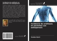 Couverture de Incidencia de urolitiasis en pacientes con osteoporosis