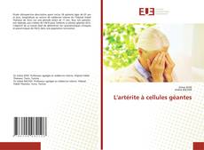 Couverture de L'artérite à cellules géantes