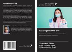 Copertina di Ancoragem intra-oral
