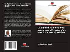 Bookcover of La dignité humaine des personnes atteintes d'un handicap mental sévère