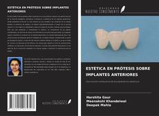 Bookcover of ESTÉTICA EN PRÓTESIS SOBRE IMPLANTES ANTERIORES