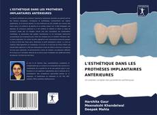 Bookcover of L'ESTHÉTIQUE DANS LES PROTHÈSES IMPLANTAIRES ANTÉRIEURES