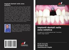 Copertina di Impianti dentali nella zona estetica