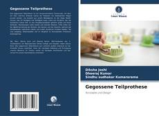 Buchcover von Gegossene Teilprothese