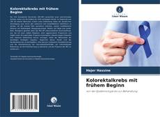 Copertina di Kolorektalkrebs mit frühem Beginn