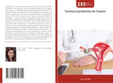 Bookcover of Tumeurs borderline de l'ovaire