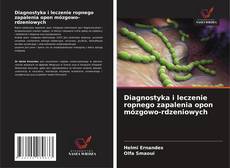 Copertina di Diagnostyka i leczenie ropnego zapalenia opon mózgowo-rdzeniowych