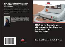 Buchcover von Effet de la thérapie par ultrasons sur les fibromes sous-séreux et intramuraux