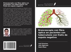 Broncoscopia con fibra óptica en pacientes con tuberculosis con frotis de esputo negativo kitap kapağı
