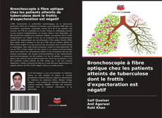 Обложка Bronchoscopie à fibre optique chez les patients atteints de tuberculose dont le frottis d'expectoration est négatif