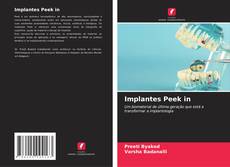 Capa do livro de Implantes Peek in 