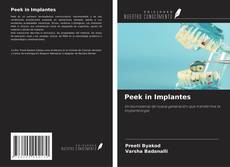 Peek in Implantes kitap kapağı