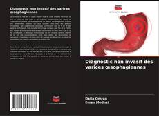Обложка Diagnostic non invasif des varices œsophagiennes