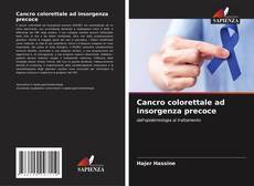 Cancro colorettale ad insorgenza precoce的封面