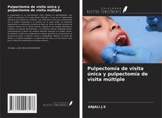 Bookcover of Pulpectomía de visita única y pulpectomía de visita múltiple