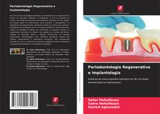 Borítókép a  Periodontologia Regenerativa e Implantologia - hoz