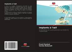 Portada del libro de Implants à l'œil