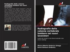 Copertina di Radiografie della colonna vertebrale lombare nei nuovi lavoratori