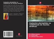 Copertina di Implantes pterigóides na reabilitação de maxilas atróficas